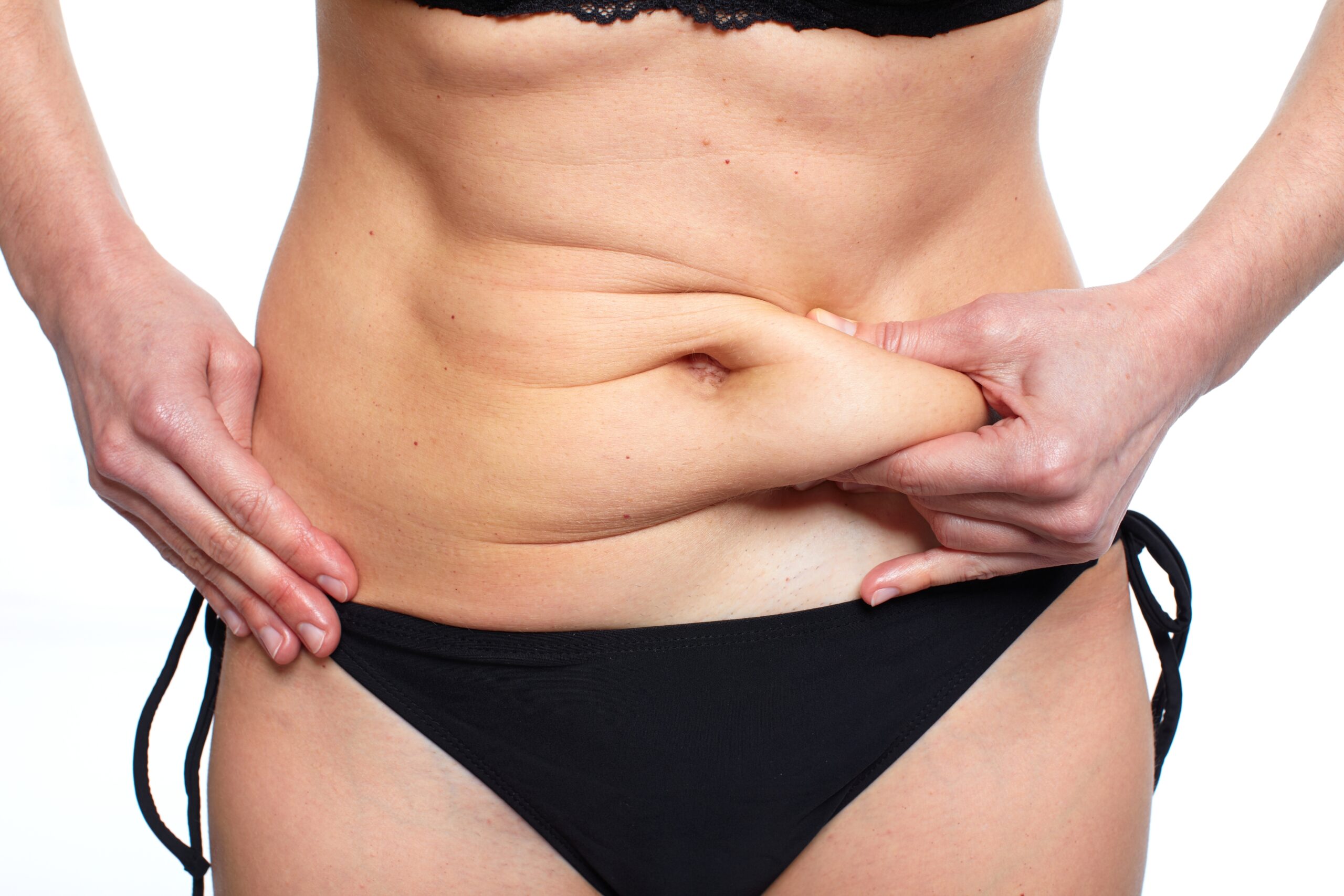 tummy tuck